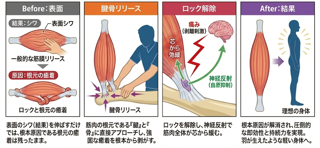 【腱骨リリース】は、一般的な筋膜リリースのように表面を揉むのではなく、筋肉の根元である「腱」と「骨」に直接アプローチする独自の革新的な施術です